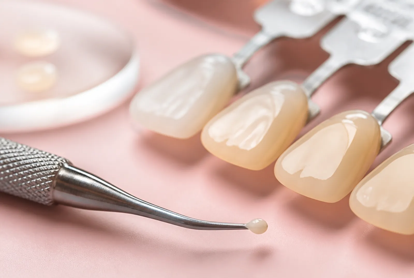 Composite bonding at Enara