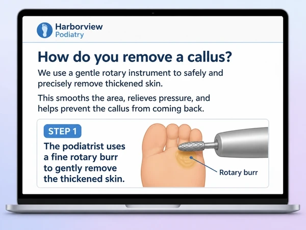 A published podiatry practice guide page answering one customer question with a simple diagram