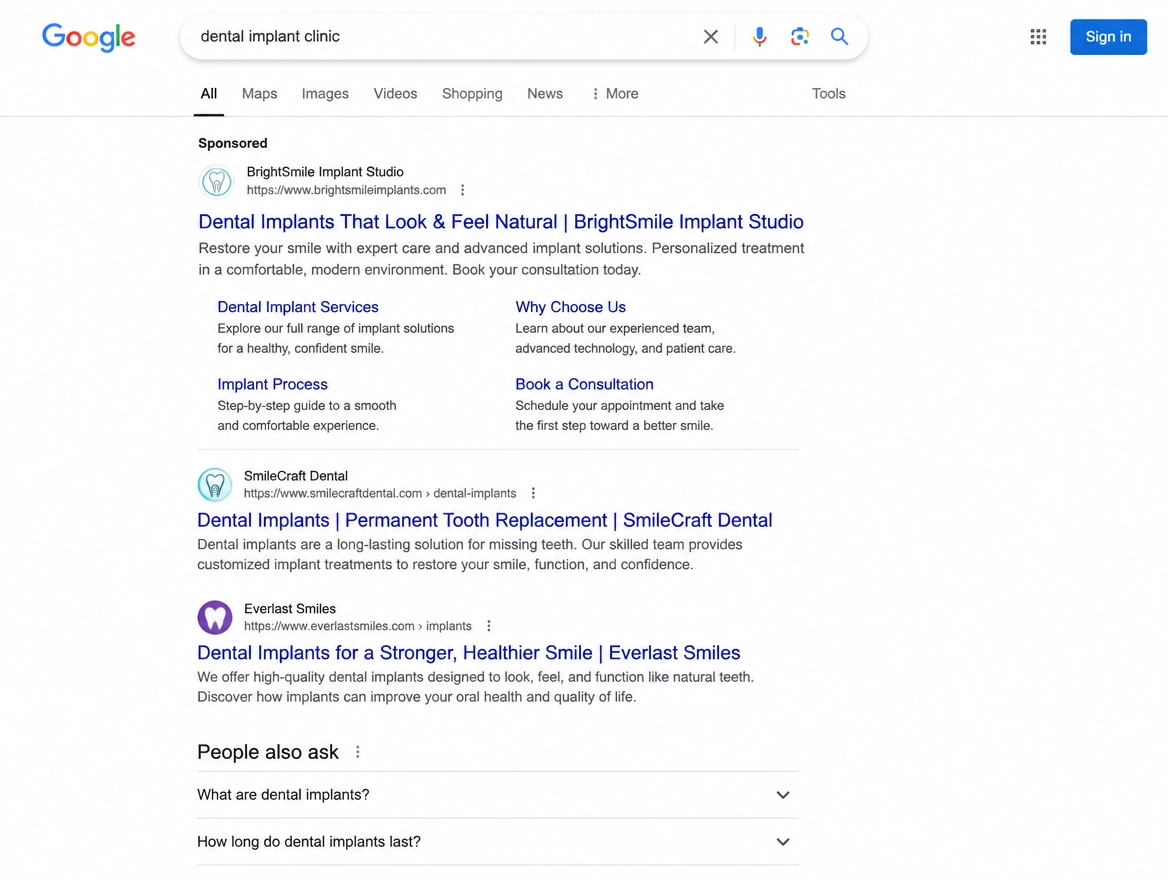 Google search results with a sponsored dental implant clinic listing first